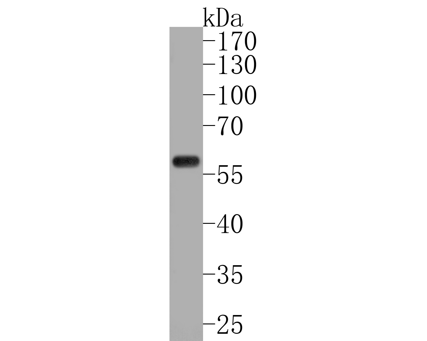 Western blot analysis of PDCD7 on rat stomach tissue lysates. Proteins were transferred to a PVDF membrane and blocked with 5% BSA in PBS for 1 hour at room temperature. The primary antibody (HA720033, 1/500) was used in 5% BSA at room temperature for 2 hours. Goat Anti-Rabbit IgG - HRP Secondary Antibody (HA1001) at 1:200,000 dilution was used for 1 hour at room temperature.