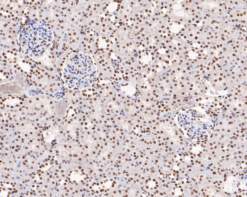 Immunohistochemical analysis of paraffin-embedded rat kidney tissue using anti-PDCD7 antibody. The section was pre-treated using heat mediated antigen retrieval with sodium citrate buffer (pH 6.0) for 20 minutes. The tissues were blocked in 5% BSA for 30 minutes at room temperature, washed with ddH2O and PBS, and then probed with the primary antibody (HA720033, 1/200)  for 30 minutes at room temperature. The detection was performed using an HRP conjugated compact polymer system. DAB was used as the chromogen. Tissues were counterstained with hematoxylin and mounted with DPX.
