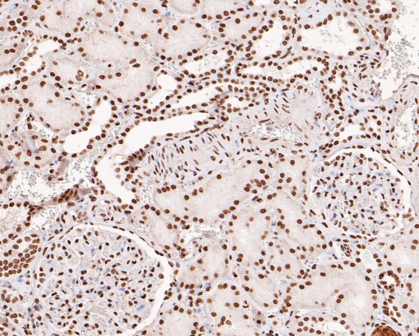 Immunohistochemical analysis of paraffin-embedded human kidney tissue using anti-PDCD7 antibody. The section was pre-treated using heat mediated antigen retrieval with sodium citrate buffer (pH 6.0) for 20 minutes. The tissues were blocked in 5% BSA for 30 minutes at room temperature, washed with ddH2O and PBS, and then probed with the primary antibody (HA720033, 1/200)  for 30 minutes at room temperature. The detection was performed using an HRP conjugated compact polymer system. DAB was used as the chromogen. Tissues were counterstained with hematoxylin and mounted with DPX.