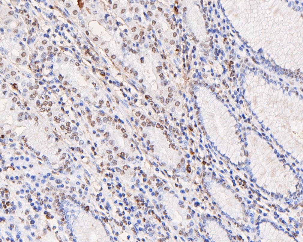 Immunohistochemical analysis of paraffin-embedded human stomach tissue using anti-PDCD7 antibody. The section was pre-treated using heat mediated antigen retrieval with sodium citrate buffer (pH 6.0) for 20 minutes. The tissues were blocked in 5% BSA for 30 minutes at room temperature, washed with ddH2O and PBS, and then probed with the primary antibody (HA720033, 1/200)  for 30 minutes at room temperature. The detection was performed using an HRP conjugated compact polymer system. DAB was used as the chromogen. Tissues were counterstained with hematoxylin and mounted with DPX.