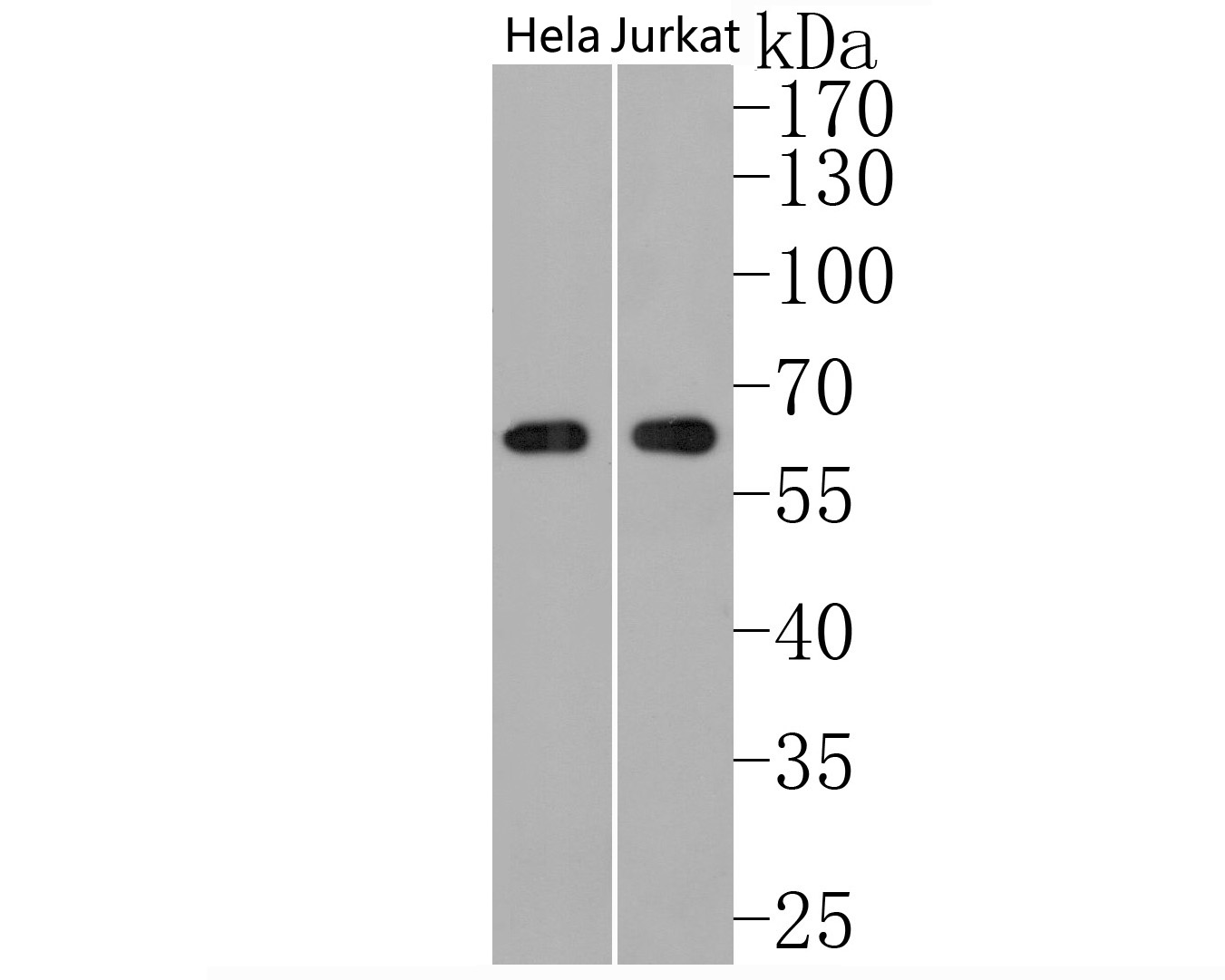 Western blot analysis of USP39 on Hela and Jurkat cell lysates. Proteins were transferred to a PVDF membrane and blocked with 5% BSA in PBS for 1 hour at room temperature. The primary antibody (HA720034, 1/500) was used in 5% BSA at room temperature for 2 hours. Goat Anti-Rabbit IgG - HRP Secondary Antibody (HA1001) at 1:200,000 dilution was used for 1 hour at room temperature.