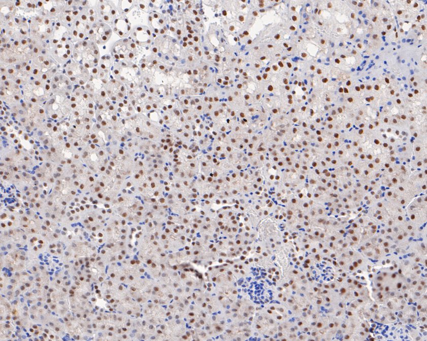 Immunohistochemical analysis of paraffin-embedded mouse kidney tissue using anti-USP39 antibody. The section was pre-treated using heat mediated antigen retrieval with sodium citrate buffer (pH 6.0) for 20 minutes. The tissues were blocked in 5% BSA for 30 minutes at room temperature, washed with ddH2O and PBS, and then probed with the primary antibody (HA720034, 1/50)  for 30 minutes at room temperature. The detection was performed using an HRP conjugated compact polymer system. DAB was used as the chromogen. Tissues were counterstained with hematoxylin and mounted with DPX.