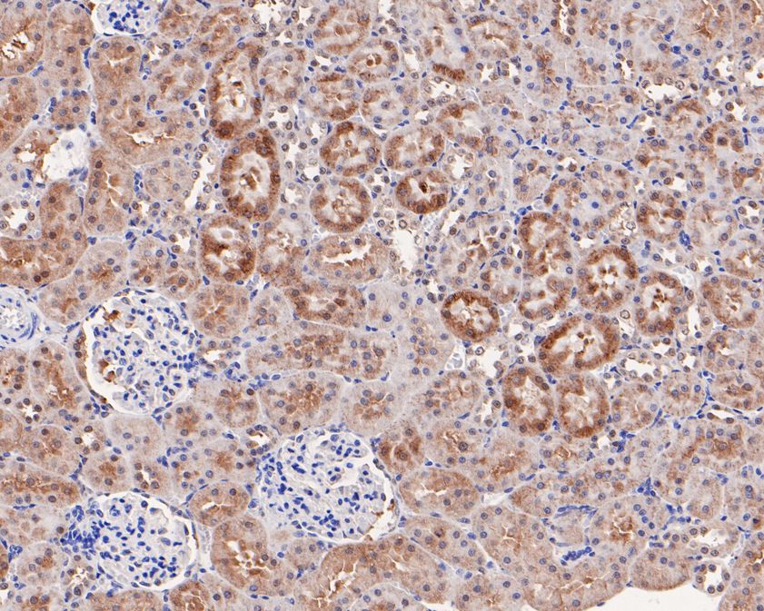 Immunohistochemical analysis of paraffin-embedded mouse kidney tissue using anti-TUG antibody. The section was pre-treated using heat mediated antigen retrieval with Tris-EDTA buffer (pH 8.0-8.4) for 20 minutes.The tissues were blocked in 5% BSA for 30 minutes at room temperature, washed with ddH2O and PBS, and then probed with the primary antibody (HA720029, 1/50) for 30 minutes at room temperature. The detection was performed using an HRP conjugated compact polymer system. DAB was used as the chromogen. Tissues were counterstained with hematoxylin and mounted with DPX.