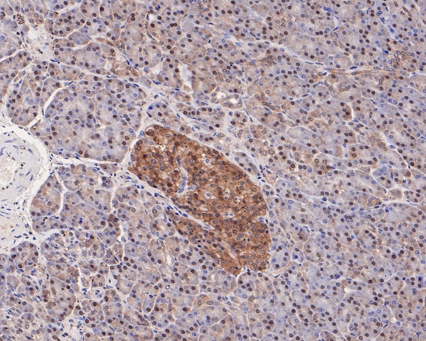 Immunohistochemical analysis of paraffin-embedded human pancreas tissue using anti-TUG antibody. The section was pre-treated using heat mediated antigen retrieval with Tris-EDTA buffer (pH 8.0-8.4) for 20 minutes.The tissues were blocked in 5% BSA for 30 minutes at room temperature, washed with ddH2O and PBS, and then probed with the primary antibody (HA720029, 1/50) for 30 minutes at room temperature. The detection was performed using an HRP conjugated compact polymer system. DAB was used as the chromogen. Tissues were counterstained with hematoxylin and mounted with DPX.