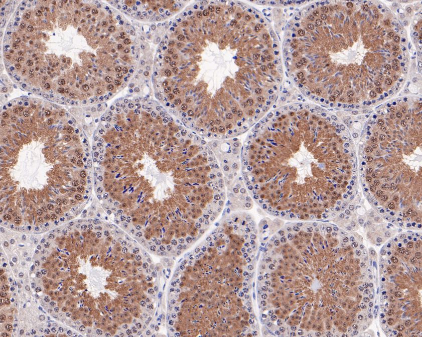 Immunohistochemical analysis of paraffin-embedded mouse testis tissue using anti-TUG antibody. The section was pre-treated using heat mediated antigen retrieval with Tris-EDTA buffer (pH 8.0-8.4) for 20 minutes.The tissues were blocked in 5% BSA for 30 minutes at room temperature, washed with ddH2O and PBS, and then probed with the primary antibody (HA720029, 1/200) for 30 minutes at room temperature. The detection was performed using an HRP conjugated compact polymer system. DAB was used as the chromogen. Tissues were counterstained with hematoxylin and mounted with DPX.