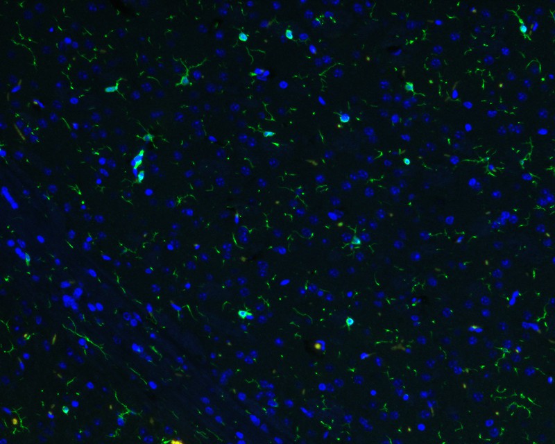 Immunohistochemical analysis of paraffin-embedded mouse hippocampus tissue with Rabbit anti-Iba1 antibody (ET1705-78) at 1/1,000 dilution.<br />
<br />
The section was pre-treated using heat mediated antigen retrieval with Tris-EDTA buffer (pH 9.0) for 20 minutes. The tissues were blocked in 1% BSA for 20 minutes at room temperature, washed with ddH2O and PBS, and then probed with the primary antibody (ET1705-78) at 1/1,000 dilution for 1 hour at room temperature. The detection was performed using an HRP conjugated compact polymer system. DAB was used as the chromogen. Tissues were counterstained with hematoxylin and mounted with DPX.