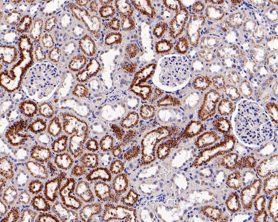 Immunohistochemical analysis of paraffin-embedded rat kidney tissue using anti-LAMP2a antibody. The section was pre-treated using heat mediated antigen retrieval with Tris-EDTA buffer (pH 8.0-8.4) for 20 minutes.The tissues were blocked in 5% BSA for 30 minutes at room temperature, washed with ddH2O and PBS, and then probed with the primary antibody (ET1601-24, 1/200) for 30 minutes at room temperature. The detection was performed using an HRP conjugated compact polymer system. DAB was used as the chromogen. Tissues were counterstained with hematoxylin and mounted with DPX.