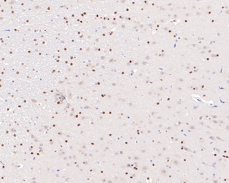 Immunohistochemical analysis of paraffin-embedded rat brain tissue with Rabbit anti-Phospho-ATF2(T71) antibody (ET1610-30) at 1/800 dilution.<br />
<br />
The section was pre-treated using heat mediated antigen retrieval with sodium citrate buffer (pH 6.0) for 2 minutes. The tissues were blocked in 1% BSA for 20 minutes at room temperature, washed with ddH2O and PBS, and then probed with the primary antibody (ET1610-30) at 1/800 dilution for 1 hour at room temperature. The detection was performed using an HRP conjugated compact polymer system. DAB was used as the chromogen. Tissues were counterstained with hematoxylin and mounted with DPX.