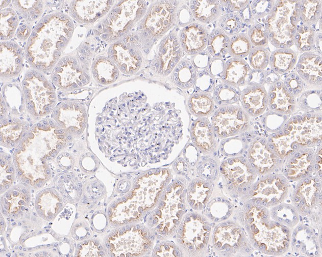 Immunohistochemical analysis of paraffin-embedded mouse brain tissue using anti-P Glycoprotein antibody. The section was pre-treated using heat mediated antigen retrieval with Tris-EDTA buffer (pH 8.0-8.4) for 20 minutes.The tissues were blocked in 5% BSA for 30 minutes at room temperature, washed with ddH2O and PBS, and then probed with the primary antibody (ET1611-30, 1/50) for 30 minutes at room temperature. The detection was performed using an HRP conjugated compact polymer system. DAB was used as the chromogen. Tissues were counterstained with hematoxylin and mounted with DPX.