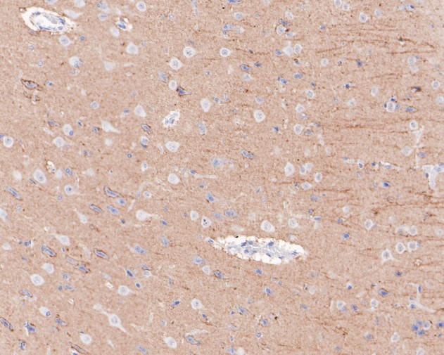 Immunohistochemical analysis of paraffin-embedded rat brain tissue using anti-CD90 antibody. The section was pre-treated using heat mediated antigen retrieval with Tris-EDTA buffer (pH 8.0-8.4) for 20 minutes.The tissues were blocked in 5% BSA for 30 minutes at room temperature, washed with ddH2O and PBS, and then probed with the primary antibody (ET1608-46, 1/200) for 30 minutes at room temperature. The detection was performed using an HRP conjugated compact polymer system. DAB was used as the chromogen. Tissues were counterstained with hematoxylin and mounted with DPX.