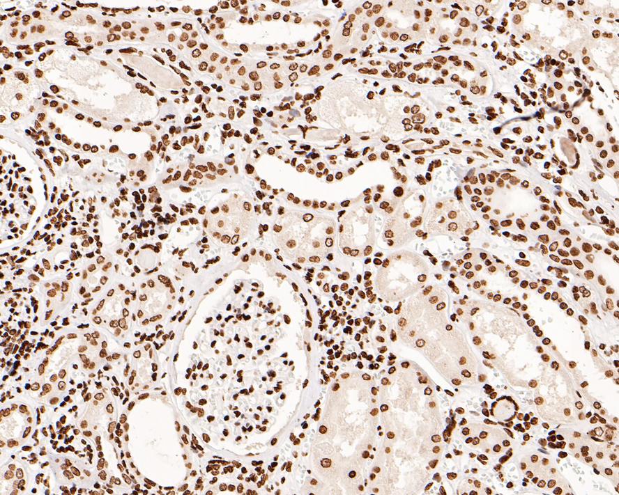 Immunohistochemical analysis of paraffin-embedded human kidney tissue using anti-Phospho-JAK2(Y1007+Y1008) antibody. The section was pre-treated using heat mediated antigen retrieval with sodium citrate buffer (pH 6.0) for 20 minutes. The tissues were blocked in 5% BSA for 30 minutes at room temperature, washed with ddH2O and PBS, and then probed with the primary antibody (ET1607-34, 1/200)  for 30 minutes at room temperature. The detection was performed using an HRP conjugated compact polymer system. DAB was used as the chromogen. Tissues were counterstained with hematoxylin and mounted with DPX.