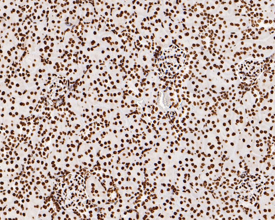 Immunohistochemical analysis of paraffin-embedded rat kidney tissue using anti-Phospho-JAK2(Y1007+Y1008) antibody. The section was pre-treated using heat mediated antigen retrieval with sodium citrate buffer (pH 6.0) for 20 minutes. The tissues were blocked in 5% BSA for 30 minutes at room temperature, washed with ddH2O and PBS, and then probed with the primary antibody (ET1607-34, 1/200)  for 30 minutes at room temperature. The detection was performed using an HRP conjugated compact polymer system. DAB was used as the chromogen. Tissues were counterstained with hematoxylin and mounted with DPX.