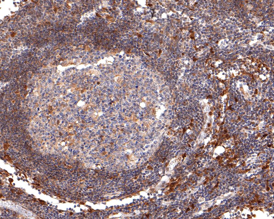 Immunohistochemical analysis of paraffin-embedded human lymph nodes tissue with Rabbit anti-TMS1 antibody (ET1611-62) at 1/400 dilution.<br />
<br />
The section was pre-treated using heat mediated antigen retrieval with Tris-EDTA buffer (pH 9.0) for 20 minutes. The tissues were blocked in 1% BSA for 20 minutes at room temperature, washed with ddH2O and PBS, and then probed with the primary antibody (ET1611-62) at 1/400 dilution for 1 hour at room temperature. The detection was performed using an HRP conjugated compact polymer system. DAB was used as the chromogen. Tissues were counterstained with hematoxylin and mounted with DPX.