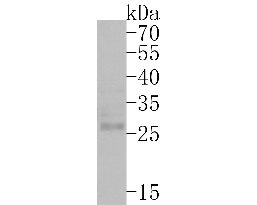 Western blot analysis of Claudin18 on 293T cell lysates. Proteins were transferred to a PVDF membrane and blocked with 5% BSA in PBS for 1 hour at room temperature. The primary antibody (HA500131, 1/1,000) was used in 5% BSA at room temperature for 2 hours. Goat Anti-Rabbit IgG - HRP Secondary Antibody (HA1001) at 1:200,000 dilution was used for 1 hour at room temperature.