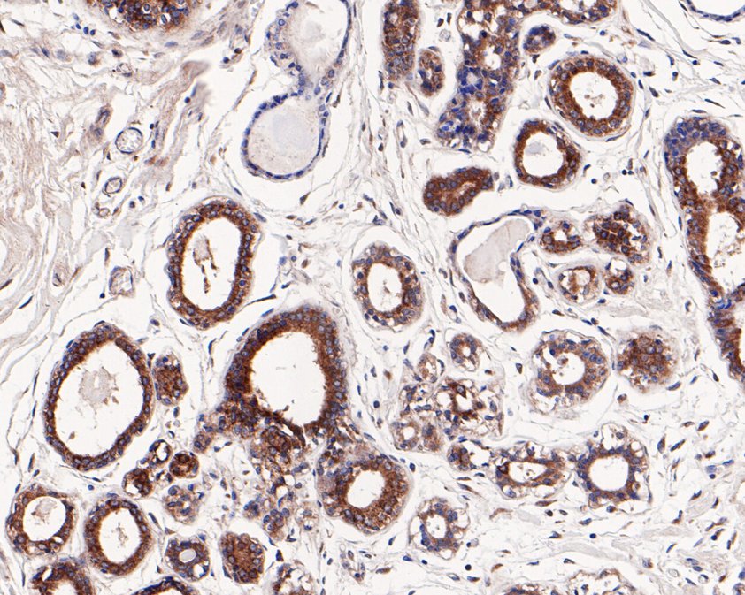 Immunohistochemical analysis of paraffin-embedded human breast tissue using anti-Rab9 antibody. The section was pre-treated using heat mediated antigen retrieval with Tris-EDTA buffer (pH 8.0-8.4) for 20 minutes.The tissues were blocked in 5% BSA for 30 minutes at room temperature, washed with ddH2O and PBS, and then probed with the primary antibody (ET1602-29, 1/50) for 30 minutes at room temperature. The detection was performed using an HRP conjugated compact polymer system. DAB was used as the chromogen. Tissues were counterstained with hematoxylin and mounted with DPX.