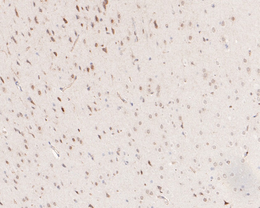 Immunohistochemical analysis of paraffin-embedded mouse brain tissue using anti-SOX1 antibody. The section was pre-treated using heat mediated antigen retrieval with sodium citrate buffer (pH 6.0) for 20 minutes. The tissues were blocked in 5% BSA for 30 minutes at room temperature, washed with ddH2O and PBS, and then probed with the primary antibody (ET1701-38, 1/50)  for 30 minutes at room temperature. The detection was performed using an HRP conjugated compact polymer system. DAB was used as the chromogen. Tissues were counterstained with hematoxylin and mounted with DPX.