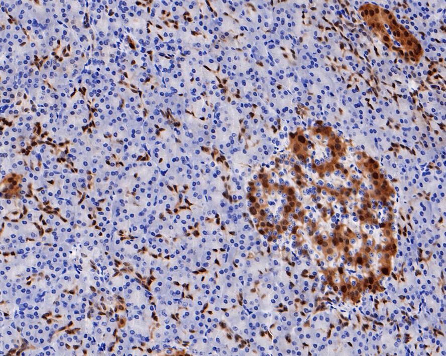 Immunohistochemical analysis of paraffin-embedded human pancreas tissue with Rabbit anti-PDX1 antibody (ET1705-99) at 1/800 dilution.<br />
<br />
The section was pre-treated using heat mediated antigen retrieval with sodium citrate buffer (pH 6.0) for 2 minutes. The tissues were blocked in 1% BSA for 20 minutes at room temperature, washed with ddH2O and PBS, and then probed with the primary antibody (ET1705-99) at 1/800 dilution for 1 hour at room temperature. The detection was performed using an HRP conjugated compact polymer system. DAB was used as the chromogen. Tissues were counterstained with hematoxylin and mounted with DPX.