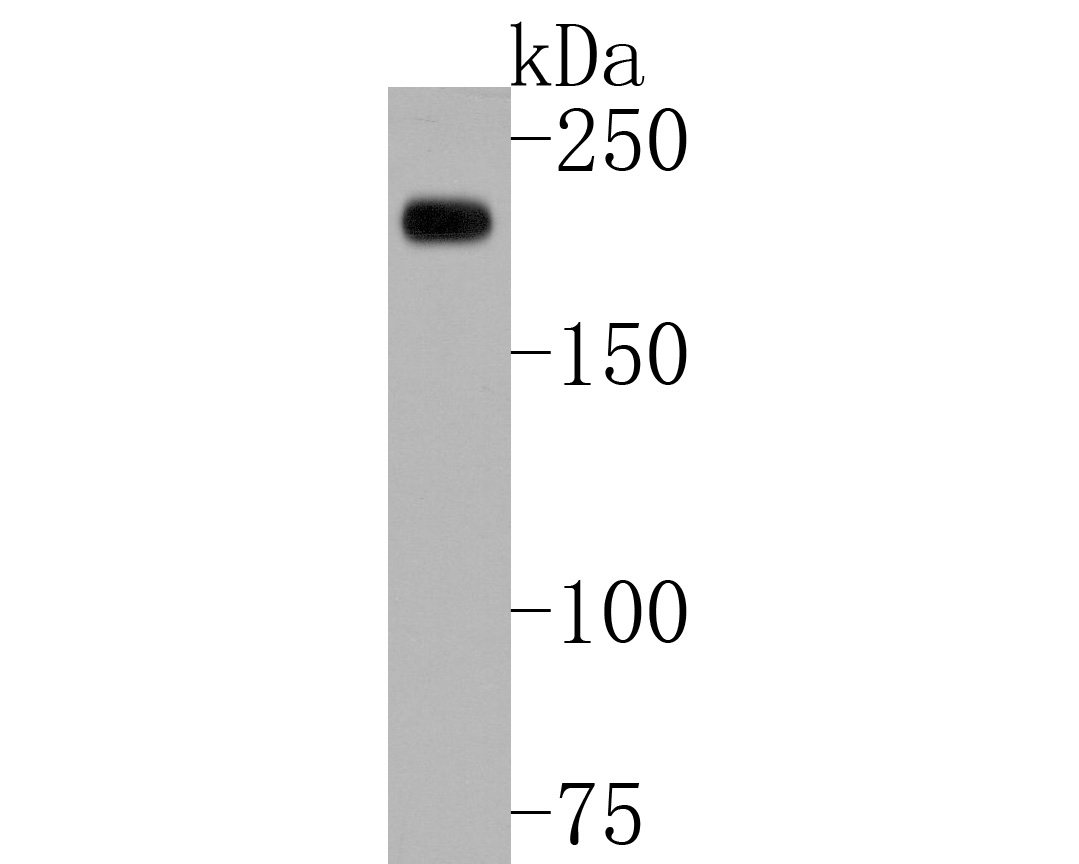 Western blot analysis of Alpha-2-macroglobulin on LO2 cell lysates. Proteins were transferred to a PVDF membrane and blocked with 5% BSA in PBS for 1 hour at room temperature. The primary antibody (M1510-24, 1/500) was used in 5% BSA at room temperature for 2 hours. Goat Anti-Mouse IgG - HRP Secondary Antibody (HA1006) at 1:5,000 dilution was used for 1 hour at room temperature.