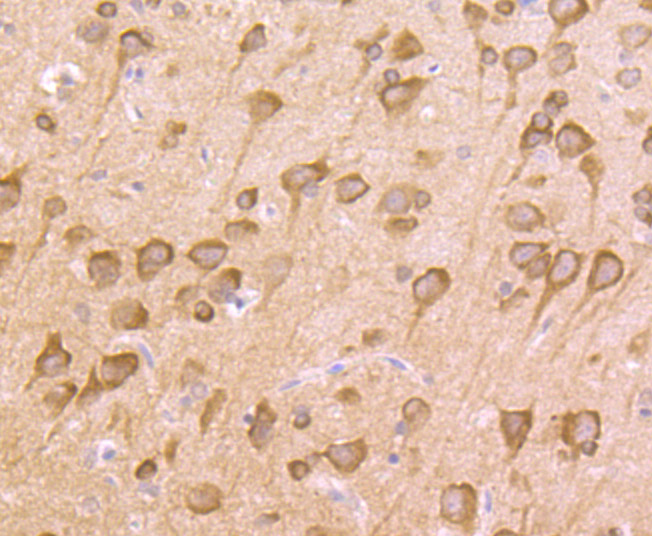 ICC staining of Nrf2 in Huvec cells (green). Formalin fixed cells were permeabilized with 0.1% Triton X-100 in TBS for 10 minutes at room temperature and blocked with 1% Blocker BSA for 15 minutes at room temperature. Cells were probed with the primary antibody (ER1706-41, 1/500) for 1 hour at room temperature, washed with PBS. Alexa Fluor®488 Goat anti-Rabbit IgG was used as the secondary antibody at 1/100 dilution. The nuclear counter stain is DAPI (blue).