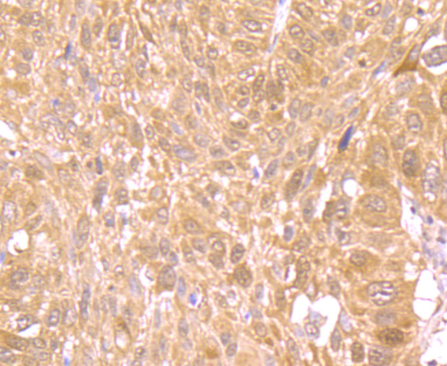 Immunohistochemical analysis of paraffin-embedded rat brain tissue using anti-Nrf2 antibody. The section was pre-treated using heat mediated antigen retrieval with Tris-EDTA buffer (pH 8.0-8.4) for 20 minutes.The tissues were blocked in 5% BSA for 30 minutes at room temperature, washed with ddH2O and PBS, and then probed with the primary antibody (ER1706-41, 1/200) for 30 minutes at room temperature. The detection was performed using an HRP conjugated compact polymer system. DAB was used as the chromogen. Tissues were counterstained with hematoxylin and mounted with DPX.