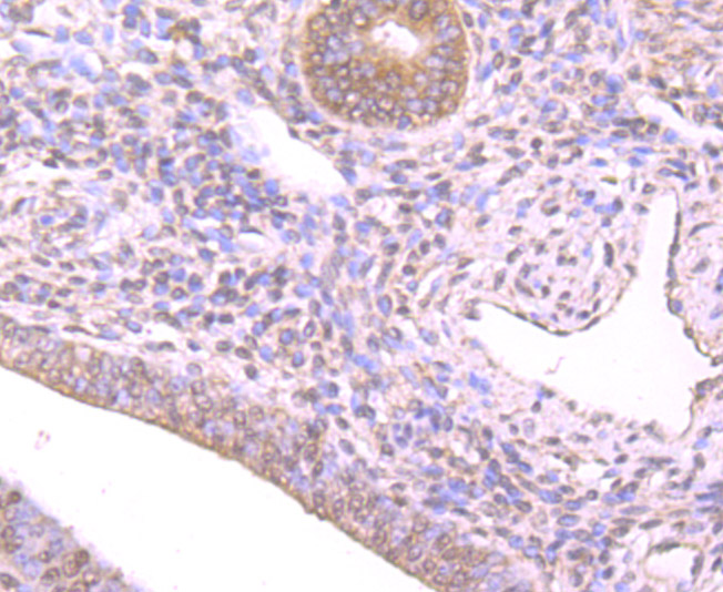 Immunohistochemical analysis of paraffin-embedded human spleen tissue using anti-Nrf2 antibody. The section was pre-treated using heat mediated antigen retrieval with Tris-EDTA buffer (pH 8.0-8.4) for 20 minutes.The tissues were blocked in 5% BSA for 30 minutes at room temperature, washed with ddH2O and PBS, and then probed with the primary antibody (ER1706-41, 1/200) for 30 minutes at room temperature. The detection was performed using an HRP conjugated compact polymer system. DAB was used as the chromogen. Tissues were counterstained with hematoxylin and mounted with DPX.