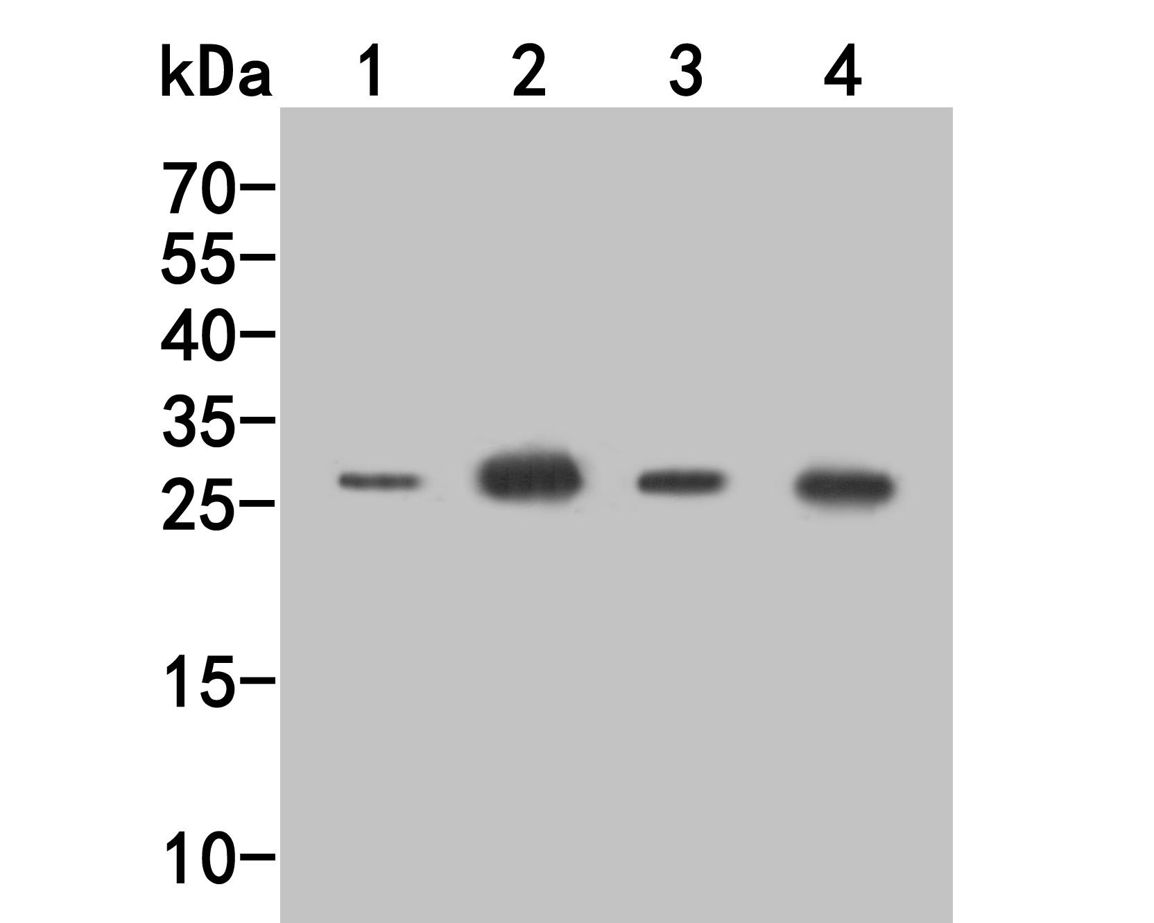 Western blot analysis of CD69 on different lysates. Proteins were transferred to a PVDF membrane and blocked with 5% BSA in PBS for 1 hour at room temperature. The primary antibody (HA500073, 1/500) was used in 5% BSA at room temperature for 2 hours. Goat Anti-Rabbit IgG - HRP Secondary Antibody (HA1001) at 1:5,000 dilution was used for 1 hour at room temperature.<br />
Positive control: <br />
Lane 1: K562 cell lysate<br />
Lane 2: Mouse bone marrow tissue lysate<br />
Lane 3: Mouse spleen tissue lysate<br />
Lane 4: HL-60 cell lysate