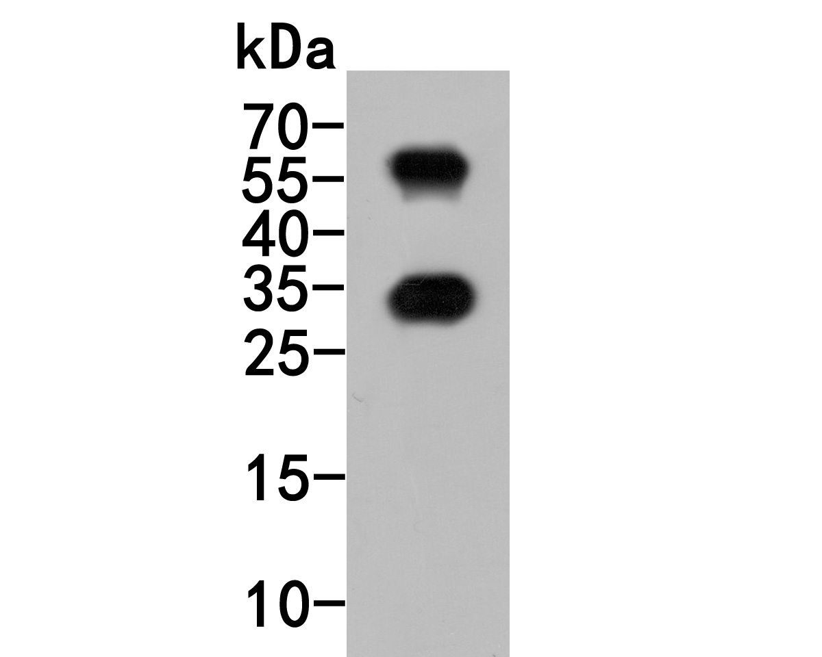 Western blot analysis of CD69 on rat bone marrow tissue  lysates. Proteins were transferred to a PVDF membrane and blocked with 5% BSA in PBS for 1 hour at room temperature. The primary antibody (HA500073, 1/500) was used in 5% BSA at room temperature for 2 hours. Goat Anti-Rabbit IgG - HRP Secondary Antibody (HA1001) at 1:5,000 dilution was used for 1 hour at room temperature.