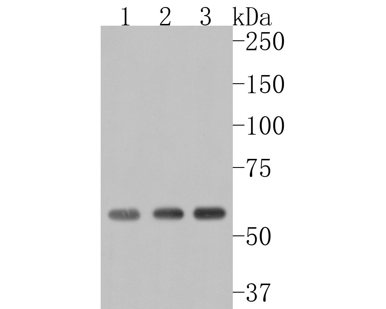 Western blot analysis of AKT2 on different lysates. Proteins were transferred to a PVDF membrane and blocked with 5% BSA in PBS for 1 hour at room temperature. The primary antibody (HA500091, 1/500) was used in 5% BSA at room temperature for 2 hours. Goat Anti-Rabbit IgG - HRP Secondary Antibody (HA1001) at 1:5,000 dilution was used for 1 hour at room temperature.<br />
Positive control: <br />
Lane 1: A549 cell lysate<br />
Lane 2: Hela cell lysate<br />
Lane 3: A431 cell lysate