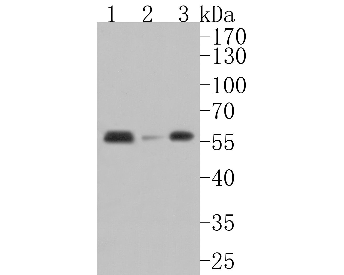 Western blot analysis of AKT2 on different lysates. Proteins were transferred to a PVDF membrane and blocked with 5% BSA in PBS for 1 hour at room temperature. The primary antibody (HA500091, 1/500) was used in 5% BSA at room temperature for 2 hours. Goat Anti-Rabbit IgG - HRP Secondary Antibody (HA1001) at 1:5,000 dilution was used for 1 hour at room temperature.<br />
Positive control: <br />
Lane 1: 293 cell lysate<br />
Lane 2: Rat brain tissue lysate<br />
Lane 3: Mouse pancreas tissue lysate