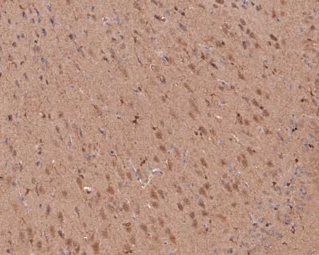 Immunohistochemical analysis of paraffin-embedded rat brain tissue using anti-AKT2 antibody. The section was pre-treated using heat mediated antigen retrieval with sodium citrate buffer (pH 6.0) for 20 minutes. The tissues were blocked in 5% BSA for 30 minutes at room temperature, washed with ddH2O and PBS, and then probed with the primary antibody (HA500091, 1/100)  for 30 minutes at room temperature. The detection was performed using an HRP conjugated compact polymer system. DAB was used as the chromogen. Tissues were counterstained with hematoxylin and mounted with DPX.
