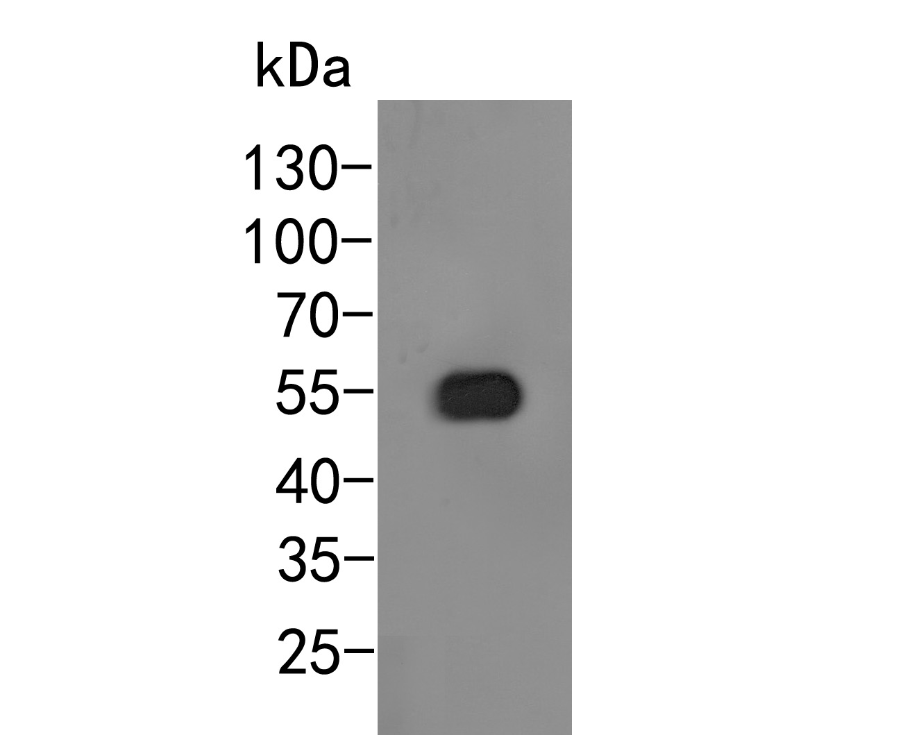 Western blot analysis of Arogenate dehydratase on Arabidopsis thaliana tissue lysates. Proteins were transferred to a PVDF membrane and blocked with 5% BSA in PBS for 1 hour at room temperature. The primary antibody (HA500108, 1/500) was used in 5% BSA at room temperature for 2 hours. Goat Anti-Rabbit IgG - HRP Secondary Antibody (HA1001) at 1:5,000 dilution was used for 1 hour at room temperature.