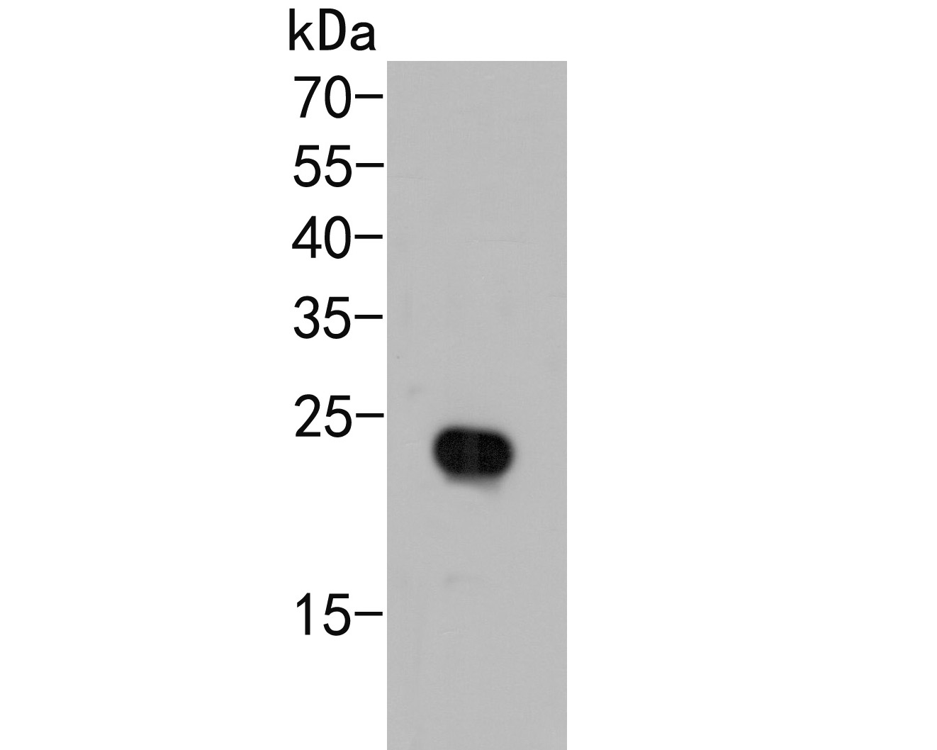 Western blot analysis of AP repeat on recombinant protein lysate. Proteins were transferred to a PVDF membrane and blocked with 5% BSA in PBS for 1 hour at room temperature. The primary antibody (HA500112, 1/500) was used in 5% BSA at room temperature for 2 hours. Goat Anti-Rabbit IgG - HRP Secondary Antibody (HA1001) at 1:5,000 dilution was used for 1 hour at room temperature.