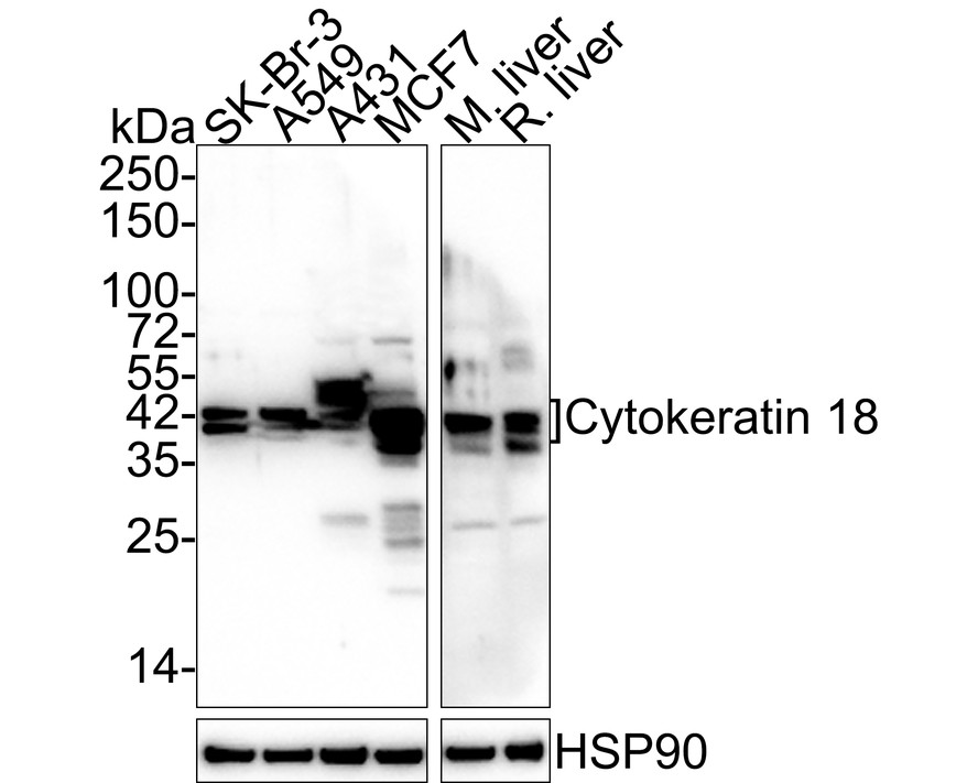 Western blot analysis of Cytokeratin 18 on different lysates. Proteins were transferred to a PVDF membrane and blocked with 5% BSA in PBS for 1 hour at room temperature. The primary antibody (HA600021, 1/500) was used in 5% BSA at room temperature for 2 hours. Goat Anti-Mouse IgG - HRP Secondary Antibody (HA1006) at 1:5,000 dilution was used for 1 hour at room temperature.<br />
Positive control: <br />
Lane 1: SK-Br-3 cell lysate<br />
Lane 2: A549 cell lysate