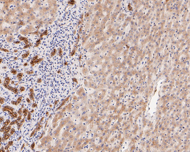 Immunohistochemical analysis of paraffin-embedded human skin tissue using anti-Cytokeratin 18 antibody. The section was pre-treated using heat mediated antigen retrieval with Tris-EDTA buffer (pH 8.0-8.4) for 20 minutes.The tissues were blocked in 5% BSA for 30 minutes at room temperature, washed with ddH2O and PBS, and then probed with the primary antibody (HA600021, 1/400) for 30 minutes at room temperature. The detection was performed using an HRP conjugated compact polymer system. DAB was used as the chromogen. Tissues were counterstained with hematoxylin and mounted with DPX.