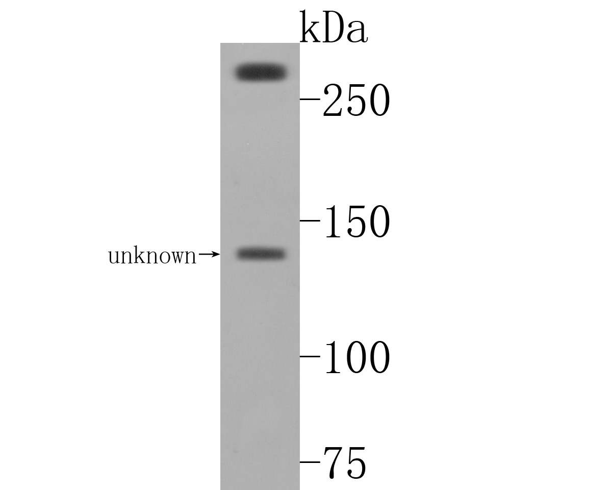 Western blot analysis of USP24 on NIH/3T3 cell lysates. Proteins were transferred to a PVDF membrane and blocked with 5% BSA in PBS for 1 hour at room temperature. The primary antibody (HA720022, 1/500) was used in 5% BSA at room temperature for 2 hours. Goat Anti-Rabbit IgG - HRP Secondary Antibody (HA1001) at 1:5,000 dilution was used for 1 hour at room temperature.