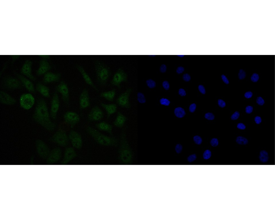 ICC staining of USP24 in HepG2 cells (green). Formalin fixed cells were permeabilized with 0.1% Triton X-100 in TBS for 10 minutes at room temperature and blocked with 1% Blocker BSA for 15 minutes at room temperature. Cells were probed with the primary antibody (HA720022, 1/50) for 1 hour at room temperature, washed with PBS. Alexa Fluor®488 Goat anti-Rabbit IgG was used as the secondary antibody at 1/1,000 dilution. The nuclear counter stain is DAPI (blue).
