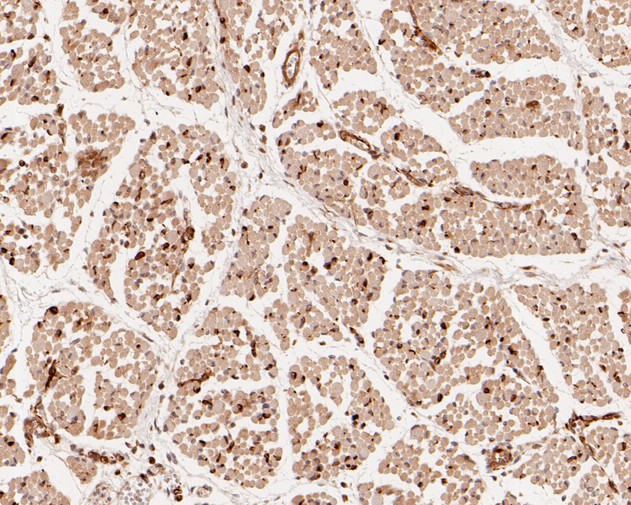 Immunohistochemical analysis of paraffin-embedded human fetal skeletal muscle tissue using anti-USP24 antibody. The section was pre-treated using heat mediated antigen retrieval with sodium citrate buffer (pH 6.0) for 20 minutes. The tissues were blocked in 5% BSA for 30 minutes at room temperature, washed with ddH2O and PBS, and then probed with the primary antibody (HA720022, 1/200)  for 30 minutes at room temperature. The detection was performed using an HRP conjugated compact polymer system. DAB was used as the chromogen. Tissues were counterstained with hematoxylin and mounted with DPX.