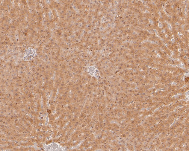 Immunohistochemical analysis of paraffin-embedded mouse liver tissue using anti-USP24 antibody. The section was pre-treated using heat mediated antigen retrieval with sodium citrate buffer (pH 6.0) for 20 minutes. The tissues were blocked in 5% BSA for 30 minutes at room temperature, washed with ddH2O and PBS, and then probed with the primary antibody (HA720022, 1/200)  for 30 minutes at room temperature. The detection was performed using an HRP conjugated compact polymer system. DAB was used as the chromogen. Tissues were counterstained with hematoxylin and mounted with DPX.