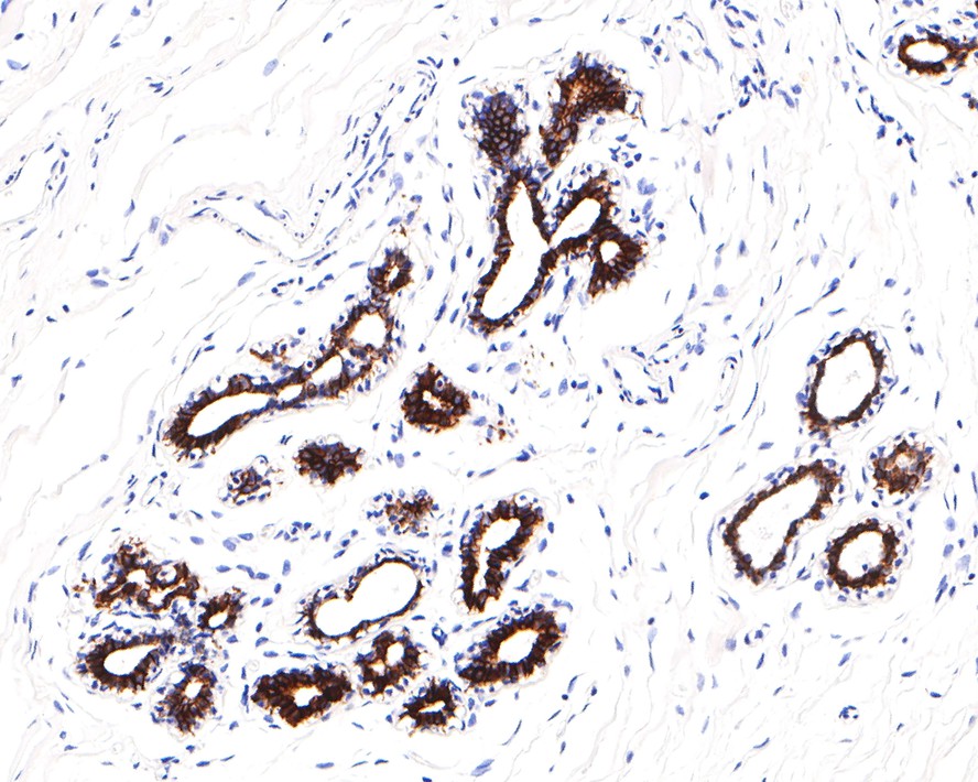 Immunohistochemical analysis of paraffin-embedded human breast tissue using anti-Cytokeratin 7 antibody. The section was pre-treated using heat mediated antigen retrieval with Tris-EDTA buffer (pH 8.0-8.4) for 20 minutes.The tissues were blocked in 5% BSA for 30 minutes at room temperature, washed with ddH2O and PBS, and then probed with the primary antibody (EM0702, 1/400) for 30 minutes at room temperature. The detection was performed using an HRP conjugated compact polymer system. DAB was used as the chromogen. Tissues were counterstained with hematoxylin and mounted with DPX.