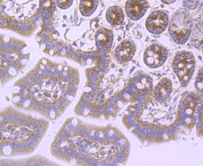 Immunohistochemical analysis of paraffin-embedded mouse colon tissue using anti-FMRP antibody. The section was pre-treated using heat mediated antigen retrieval with Tris-EDTA buffer (pH 8.0-8.4) for 20 minutes.The tissues were blocked in 5% BSA for 30 minutes at room temperature, washed with ddH2O and PBS, and then probed with the primary antibody (ET1703-70, 1/50) for 30 minutes at room temperature. The detection was performed using an HRP conjugated compact polymer system. DAB was used as the chromogen. Tissues were counterstained with hematoxylin and mounted with DPX.