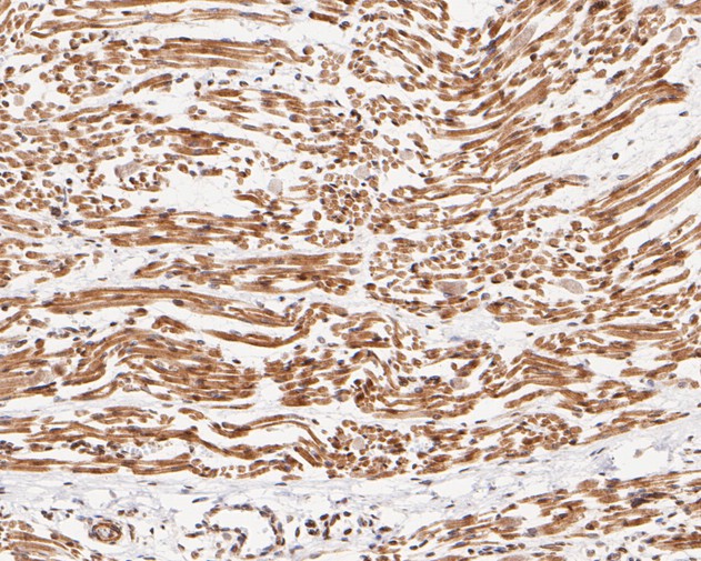 Immunohistochemical analysis of paraffin-embedded human fetal skeletal muscle tissue using anti-Ube2B antibody. The section was pre-treated using heat mediated antigen retrieval with sodium citrate buffer (pH 6.0) for 20 minutes. The tissues were blocked in 5% BSA for 30 minutes at room temperature, washed with ddH2O and PBS, and then probed with the primary antibody (ET7111-09, 1/50)  for 30 minutes at room temperature. The detection was performed using an HRP conjugated compact polymer system. DAB was used as the chromogen. Tissues were counterstained with hematoxylin and mounted with DPX.