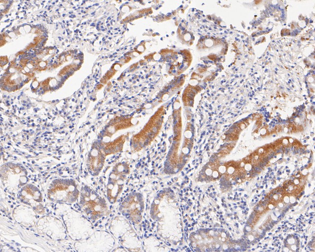 Immunohistochemical analysis of paraffin-embedded human small intestine tissue using anti-ALKBH1 antibody. The section was pre-treated using heat mediated antigen retrieval with sodium citrate buffer (pH 6.0) for 20 minutes. The tissues were blocked in 5% BSA for 30 minutes at room temperature, washed with ddH2O and PBS, and then probed with the primary antibody (ET7111-31, 1/50)  for 30 minutes at room temperature. The detection was performed using an HRP conjugated compact polymer system. DAB was used as the chromogen. Tissues were counterstained with hematoxylin and mounted with DPX.