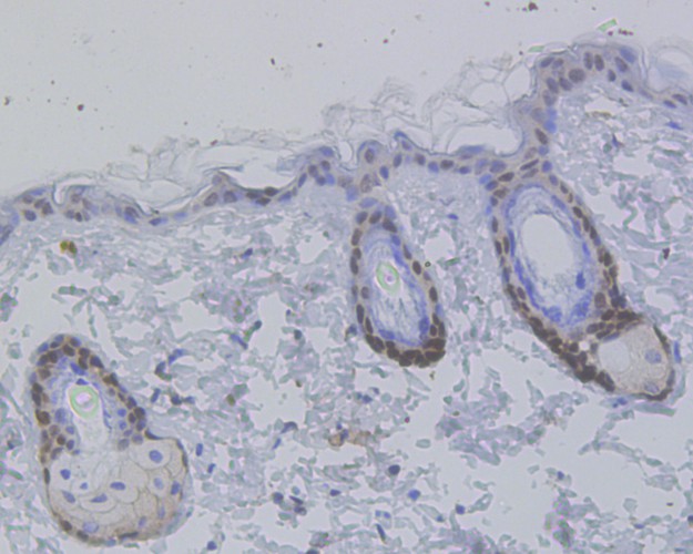 Immunohistochemical analysis of paraffin-embedded mouse skin tissue using anti-Vitamin D Receptor antibody. The section was pre-treated using heat mediated antigen retrieval with sodium citrate buffer (pH 6.0) for 20 minutes. The tissues were blocked in 5% BSA for 30 minutes at room temperature, washed with ddH2O and PBS, and then probed with the primary antibody (ET1704-09, 1/50)  for 30 minutes at room temperature. The detection was performed using an HRP conjugated compact polymer system. DAB was used as the chromogen. Tissues were counterstained with hematoxylin and mounted with DPX.