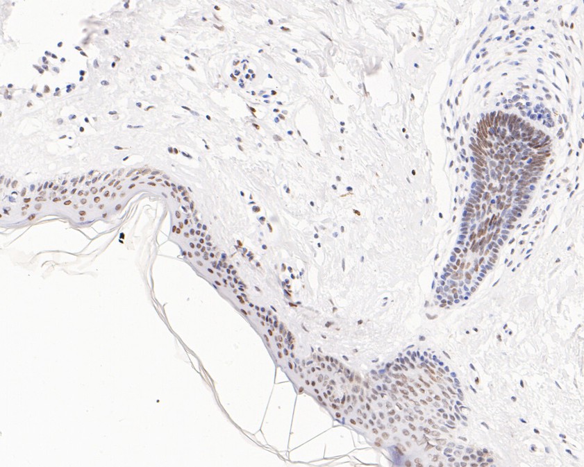 Immunohistochemical analysis of paraffin-embedded human skin tissue using anti-hnRNP A1 antibody. The section was pre-treated using heat mediated antigen retrieval with sodium citrate buffer (pH 6.0) for 20 minutes. The tissues were blocked in 5% BSA for 30 minutes at room temperature, washed with ddH2O and PBS, and then probed with the primary antibody (ET1704-52, 1/200)  for 30 minutes at room temperature. The detection was performed using an HRP conjugated compact polymer system. DAB was used as the chromogen. Tissues were counterstained with hematoxylin and mounted with DPX.