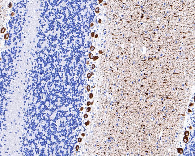 Immunohistochemical analysis of paraffin-embedded mouse cerebellum tissue using anti-IP3 Receptor antibody. The section was pre-treated using heat mediated antigen retrieval with Tris-EDTA buffer (pH 8.0-8.4) for 20 minutes.The tissues were blocked in 5% BSA for 30 minutes at room temperature, washed with ddH2O and PBS, and then probed with the primary antibody (ET1704-77, 1/200) for 30 minutes at room temperature. The detection was performed using an HRP conjugated compact polymer system. DAB was used as the chromogen. Tissues were counterstained with hematoxylin and mounted with DPX.