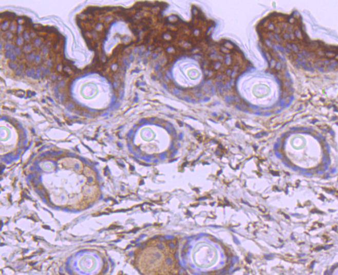 Immunohistochemical analysis of paraffin-embedded mouse heart tissue using anti-Apaf-1 antibody. The section was pre-treated using heat mediated antigen retrieval with Tris-EDTA buffer (pH 8.0-8.4) for 20 minutes.The tissues were blocked in 5% BSA for 30 minutes at room temperature, washed with ddH2O and PBS, and then probed with the primary antibody (ET1607-12, 1/50) for 30 minutes at room temperature. The detection was performed using an HRP conjugated compact polymer system. DAB was used as the chromogen. Tissues were counterstained with hematoxylin and mounted with DPX.