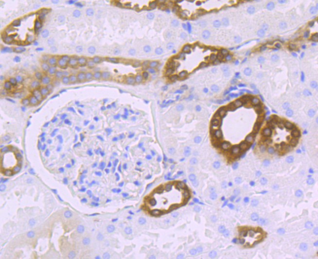 Immunohistochemical analysis of paraffin-embedded  human kidney tissue with Rabbit anti-HPRT antibody (ET1706-08) at 1/50 dilution.<br />
<br />
The section was pre-treated using heat mediated antigen retrieval with Tris-EDTA buffer (pH 8.0-8.4) for 20 minutes. The tissues were blocked in 1% BSA for 20 minutes at room temperature, washed with ddH2O and PBS, and then probed with the primary antibody (ET1706-08) at 1/50 dilution for 0.5 hour at room temperature. The detection was performed using an HRP conjugated compact polymer system. DAB was used as the chromogen. Tissues were counterstained with hematoxylin and mounted with DPX.