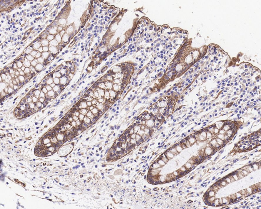 Immunohistochemical analysis of paraffin-embedded mouse stomach tissue using anti-Integrin alpha 6 antibody. The section was pre-treated using heat mediated antigen retrieval with Tris-EDTA buffer (pH 8.0-8.4) for 20 minutes.The tissues were blocked in 5% BSA for 30 minutes at room temperature, washed with ddH2O and PBS, and then probed with the primary antibody (ET1602-1, 1/50) for 30 minutes at room temperature. The detection was performed using an HRP conjugated compact polymer system. DAB was used as the chromogen. Tissues were counterstained with hematoxylin and mounted with DPX.