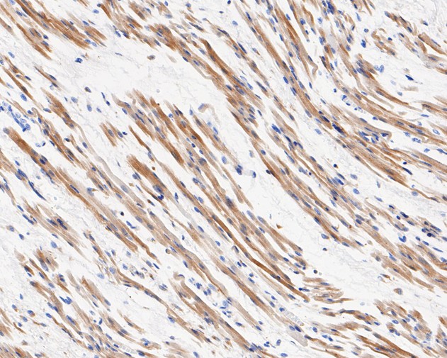 Immunohistochemical analysis of paraffin-embedded human fetal skeletal muscle tissue using anti-Phospho-Hormone sensitive lipase (S853) antibody. The section was pre-treated using heat mediated antigen retrieval with Tris-EDTA buffer (pH 8.0-8.4) for 20 minutes.The tissues were blocked in 5% BSA for 30 minutes at room temperature, washed with ddH2O and PBS, and then probed with the primary antibody (ET1611-19, 1/50) for 30 minutes at room temperature. The detection was performed using an HRP conjugated compact polymer system. DAB was used as the chromogen. Tissues were counterstained with hematoxylin and mounted with DPX.