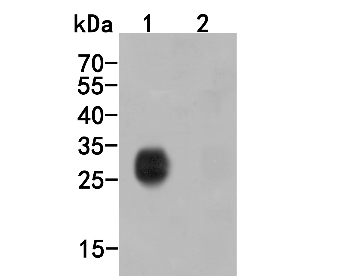 Western blot analysis of HA tag on different lysates. Proteins were transferred to a PVDF membrane and blocked with 5% BSA in PBS for 1 hour at room temperature. The primary antibody (ET1611-49, 1/2,000) was used in 5% BSA at room temperature for 2 hours. Goat Anti-Rabbit IgG - HRP Secondary Antibody (HA1001) at 1:5,000 dilution was used for 1 hour at room temperature.<br />
Positive control: <br />
Lane 1: C-terminal HA-tagged recombinant protein<br />
Lane 2: N-terminal HA-tagged recombinant protein